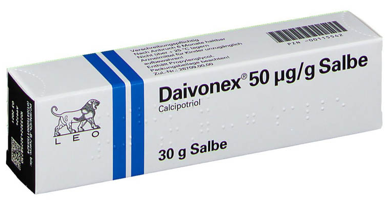 Vẩy nến nhẹ là gì? Có bao nhiêu phương pháp điều trị bệnh vảy nến nhẹ? 3
