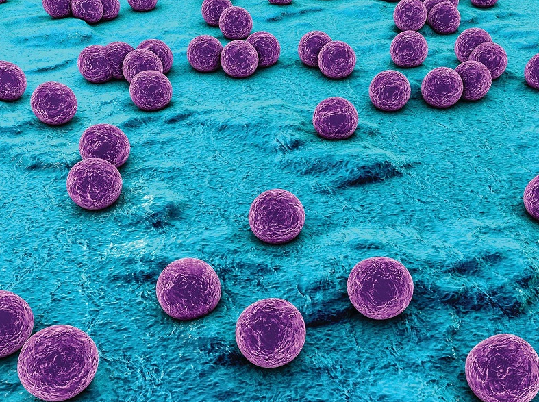 Viêm hạch bạch huyết là bệnh gì? 2