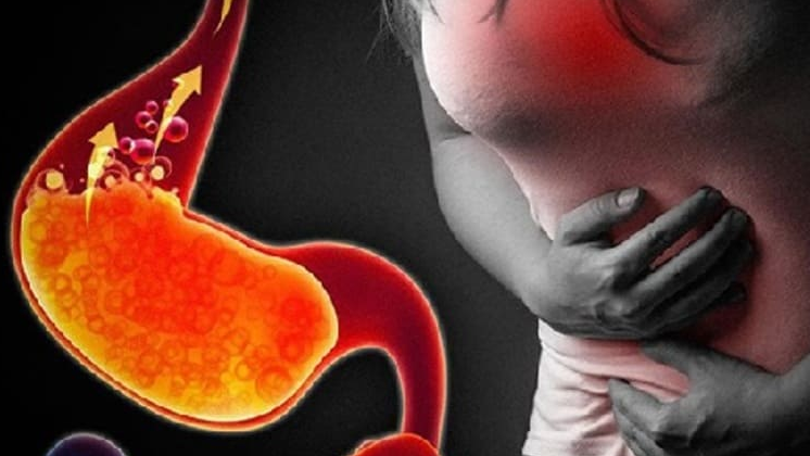 Viêm phù nề xung huyết trợt rải rác hang vị là bệnh gì? 3