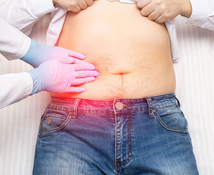 Viêm túi mật do sỏi: Căn bệnh nguy hiểm, có thể gây tử vong 2