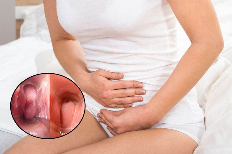 Vùng kín ra dịch màu nâu đen không mùi là do nguyên nhân nào? 3