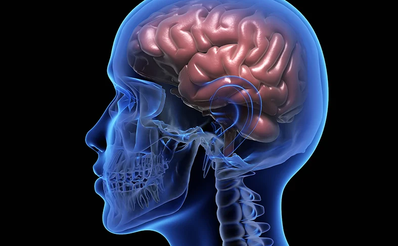 Xuất huyết nội sọ là gì? Có nguy hiểm không? 3