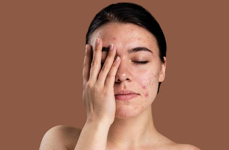 Bạn đã biết nên dùng kem chống nắng Bioderma cho da nhạy cảm nào hay chưa? 1