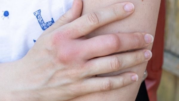 ban-tay-bi-sung-nguyen-nhan-va-cach-xu-tri 1