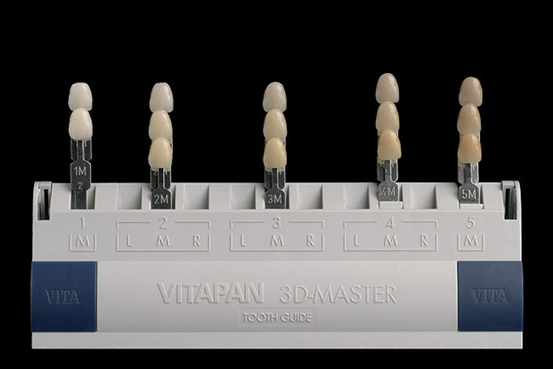 Bảng màu răng sứ mới nhất hiện nay. Nên chọn màu nào đẹp?