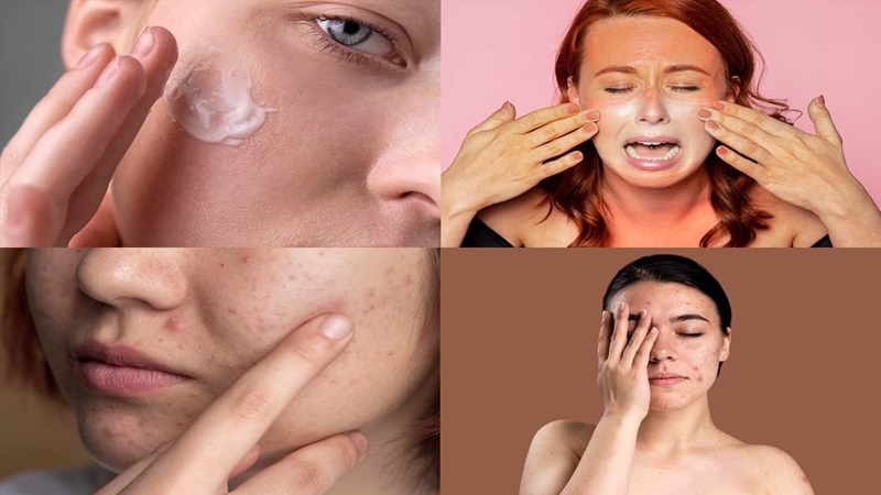 Bật mí mẹo chăm sóc da mùa hè khoa học và hiệu quả 2