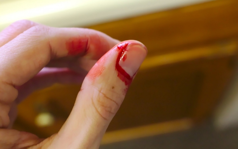 Bật móng tay sau thời gian bao lâu sẽ phục hồi? 4