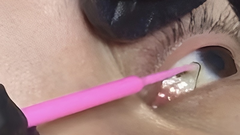 Bắt sâu mắt lợi hay hại? Đọc ngay chia sẻ của các chuyên gia 1