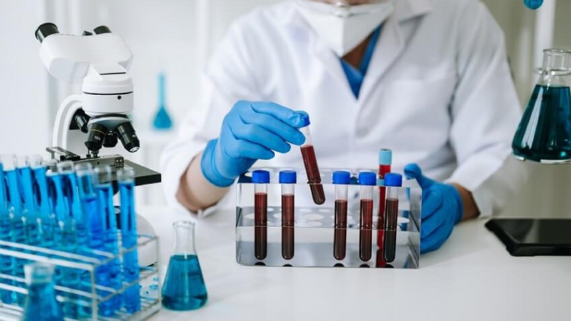 Bệnh Hodgkin và những thông tin quan trọng nhất 4