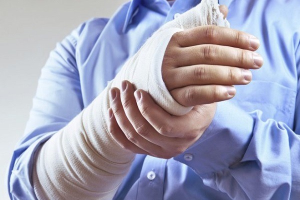 Bệnh nhân bị cứng khớp ngón tay sau bó bột 1