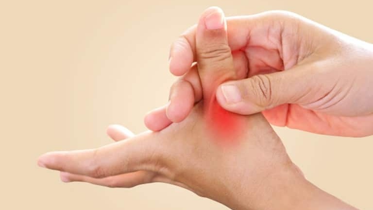 Bệnh nhân bị cứng khớp ngón tay sau bó bột 2