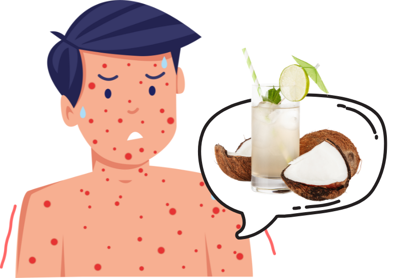 Bệnh nhân bị thủy đậu uống nước dừa được không? 2