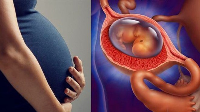 Bệnh nhân viêm phần phụ có thai được không? 2