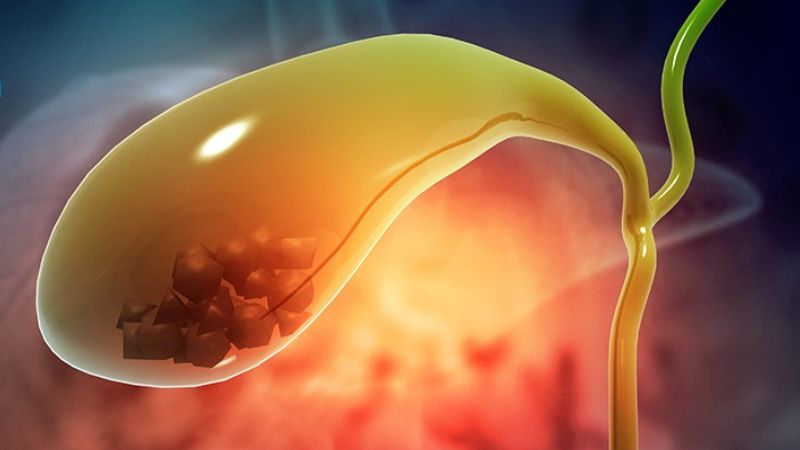 Bệnh OMC là gì và nguyên nhân, dấu hiệu, cách phòng ngừa 1