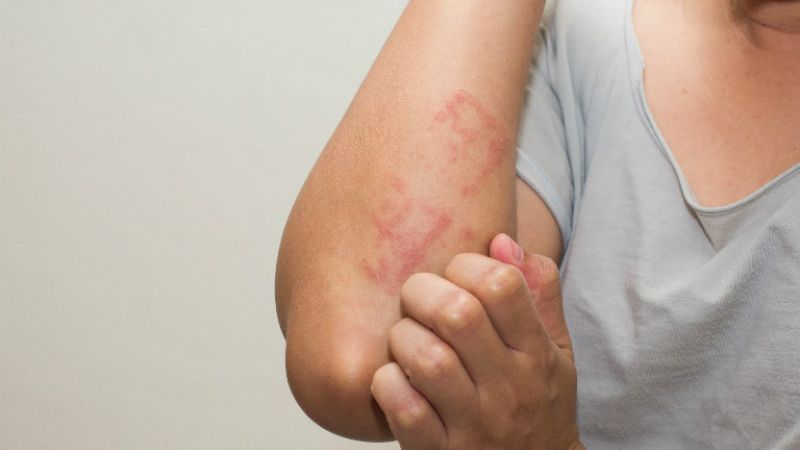 Bệnh OMC là gì và nguyên nhân, dấu hiệu, cách phòng ngừa 3