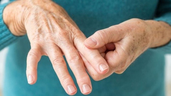 benh-viem-da-khop-co-chua-duoc-khong-nhung-dieu-can-biet 1