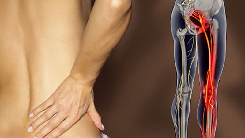 Bị đau thần kinh tọa có nên đạp xe không? 1