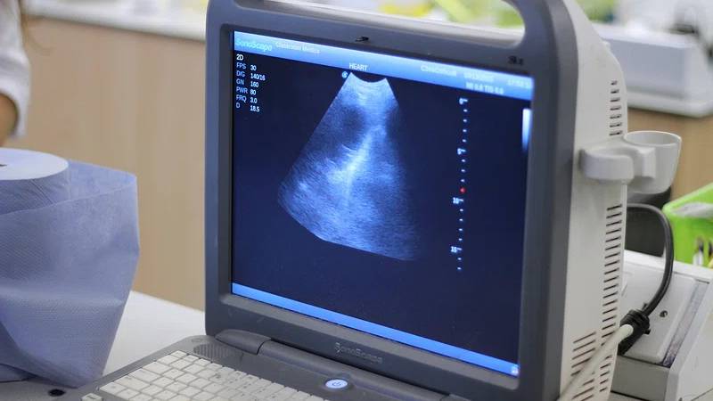 Bị dọa sảy thai có giữ được không? Làm gì khi bị dọa sảy thai? 2