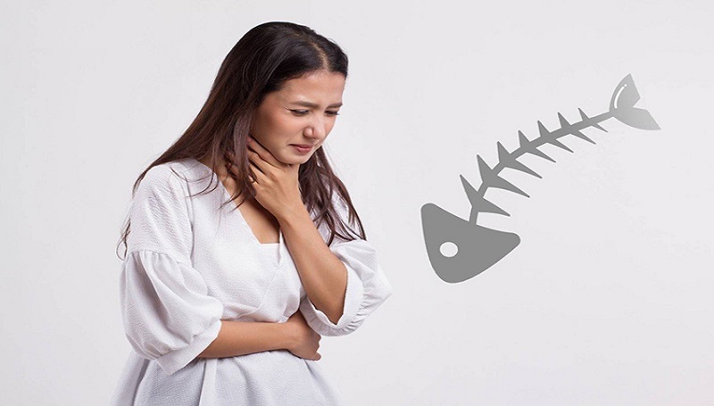 Bị hóc xương cá lâu ngày có đáng ngại không? 2