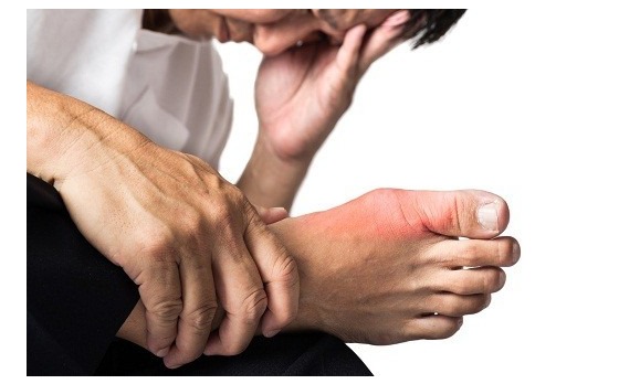 Biến dạng ngón chân cái là do đâu? Cách xử lý như thế nào? 2