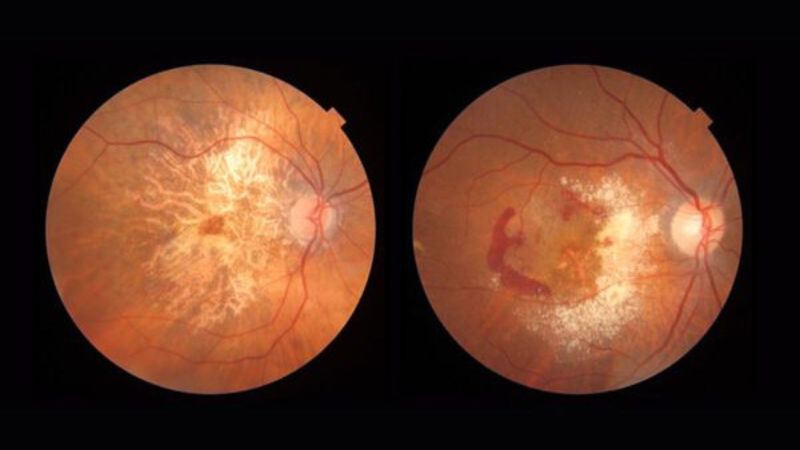 Biện pháp cải thiện thị lực với viên uống Vitabiotics Visionace Original 2