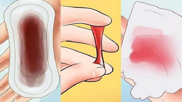 Giải đáp: Viêm lộ tuyến cổ tử cung 1cm nặng hay nhẹ? 3