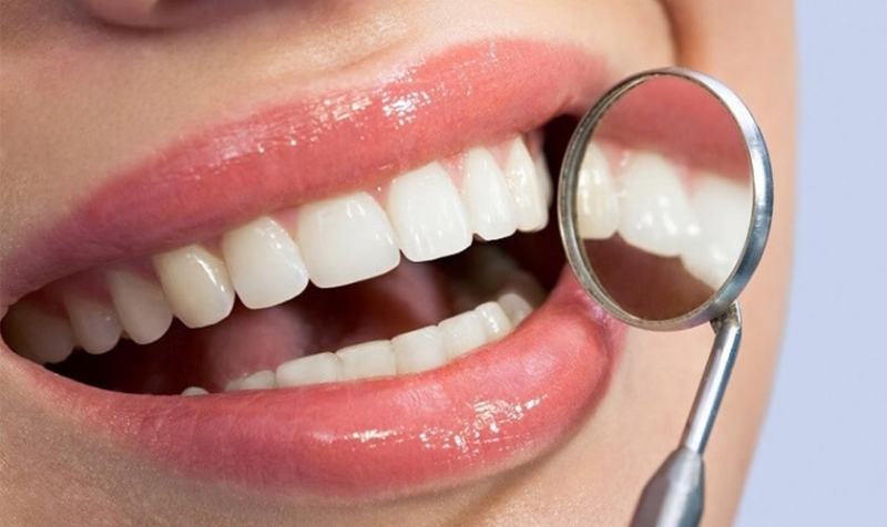 Bọc răng sứ có gây đau đớn không? Những cảm giác sau khi bọc răng sứ cần lưu ý là gì? 2