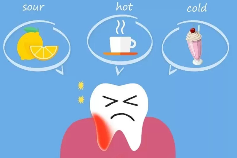 Bọc răng sứ có gây đau đớn không? Những cảm giác sau khi bọc răng sứ cần lưu ý là gì? 3