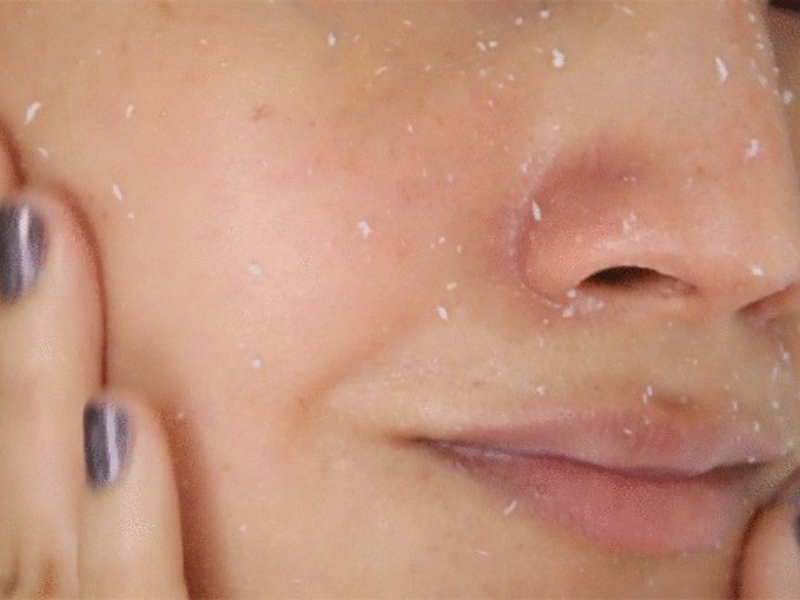 Bôi kem chống nắng bị vón cục phải làm sao?2