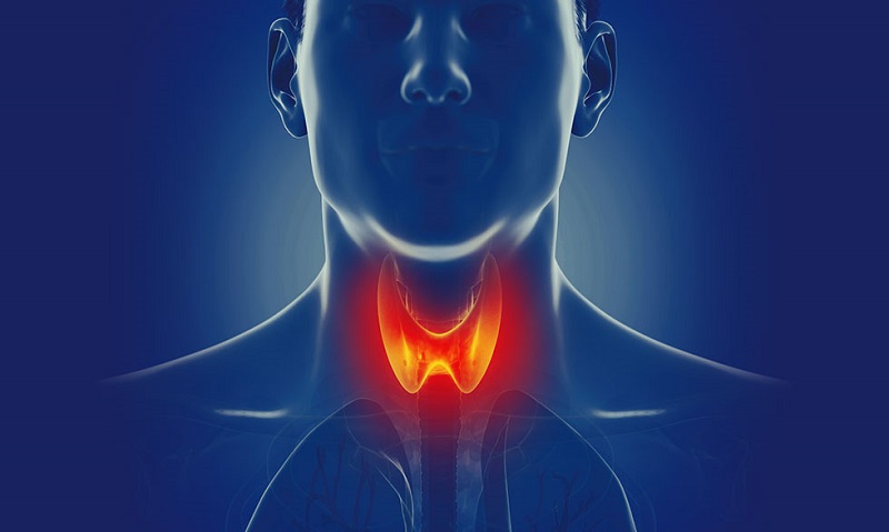 Bướu độc là gì? Bướu độc có nguy hiểm không? 2