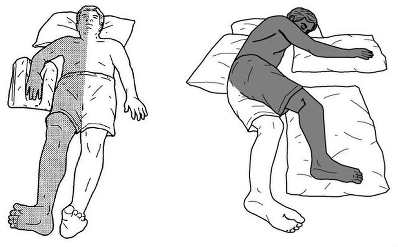 Các bài tập phục hồi chức năng cho bệnh nhân liệt nửa người 2