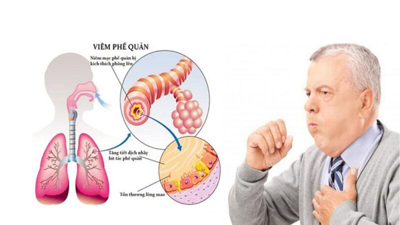 Các bệnh thường gặp trong mùa đông và cách phòng tránh 4