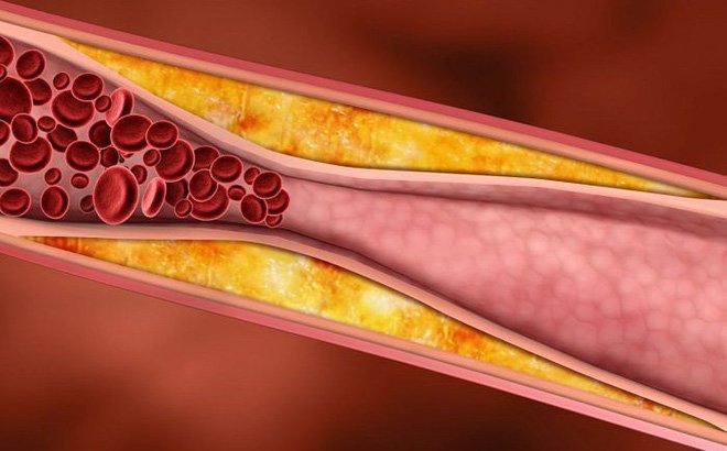 cac-benh-ve-tim-anh-huong-den-suc-khoe-va-tinh-mang-cua-nguoi-benh 2.jpg