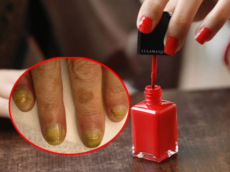 Các chất trong sơn móng tay có hại không? Nên lưu ý gì khi chọn sơn móng tay? 3