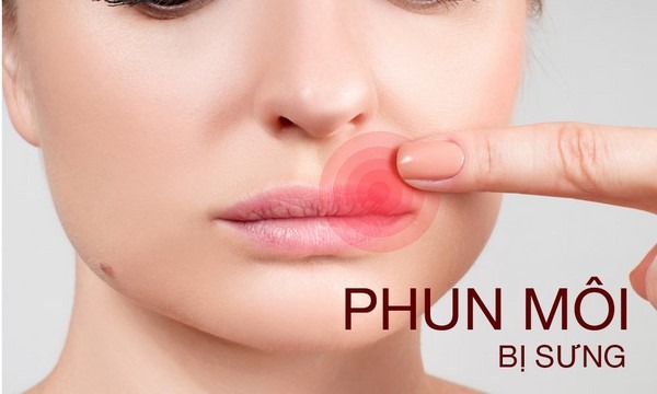 Các dấu hiệu môi bị viêm sau phun 2