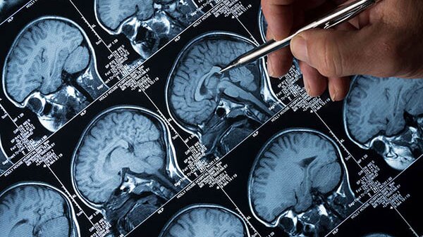 cac-ky-thuat-chan-doan-hinh-anh-u-nao 1.jpg