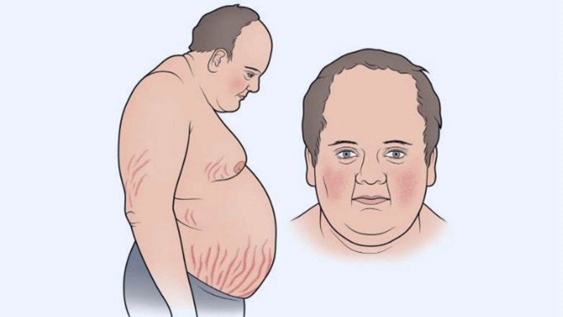 cac-loai-thuoc-giam-dau-xuong-khop-hieu-qua 4.jpg