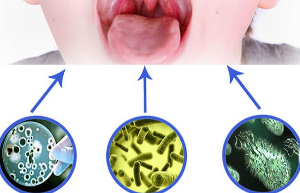 Các loại thuốc kháng sinh chữa viêm mũi họng phổ biến 2