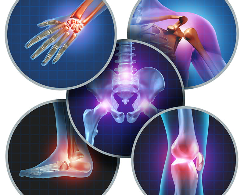 Các nguyên nhân gây đau cơ và cách khắc phục 3