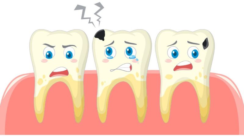 Các phương pháp chữa sâu răng cho trẻ 4 tuổi hiệu quả 2