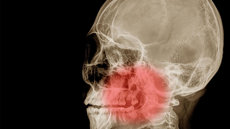 Chụp CT hàm mặt: Các trường hợp chỉ định và chống chỉ định 3