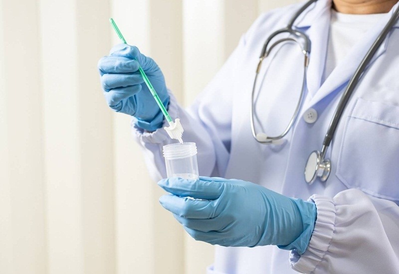 cac-xet-nghiem-tam-soat-ung-thu-co-tu-cung-hien-nay 3.jpg