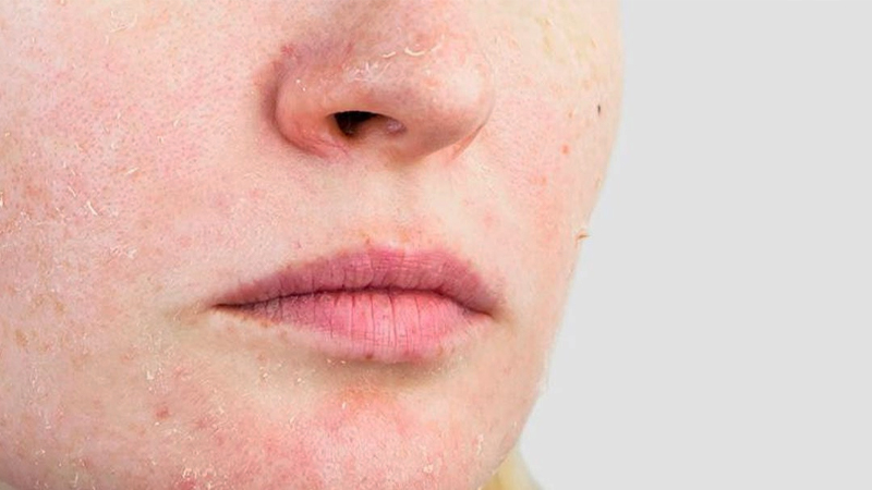 cach-cham-soc-da-nhay-cam-vao-mua-dong 2.jpg