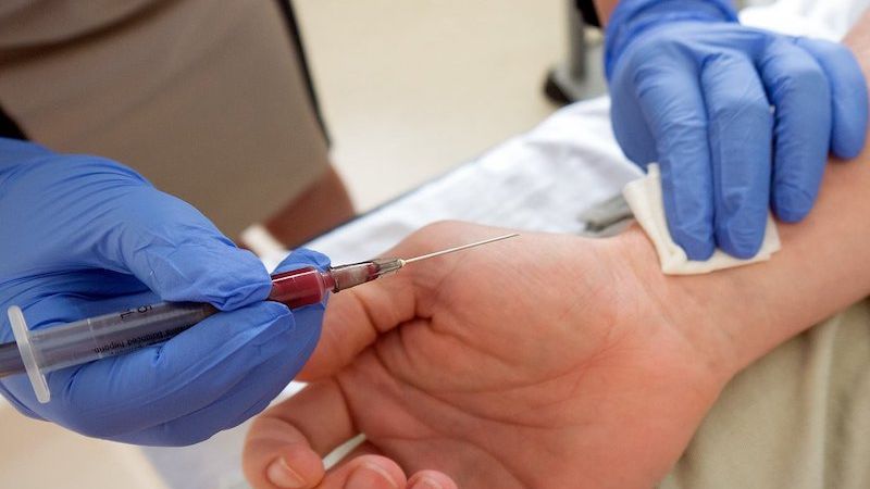 Cách đánh giá hoạt động của động mạch quay bằng nghiệm pháp Allen 1