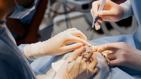 cach-dieu-tri-nang-gan-nhung-dieu-can-biet-ve-nang-gan 3