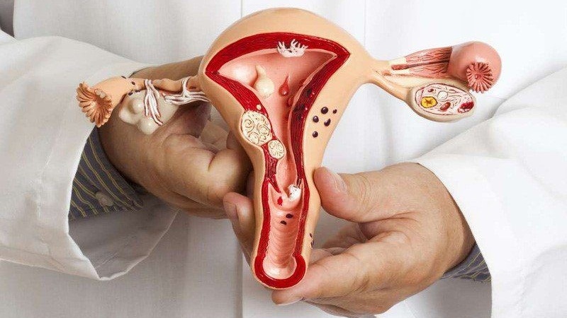 cach-doc-ket-qua-chup-tu-cung-voi-trung-nhung-luu-y-can-biet 1