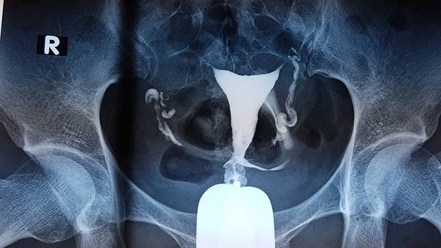 cach-doc-ket-qua-chup-tu-cung-voi-trung-nhung-luu-y-can-biet 2