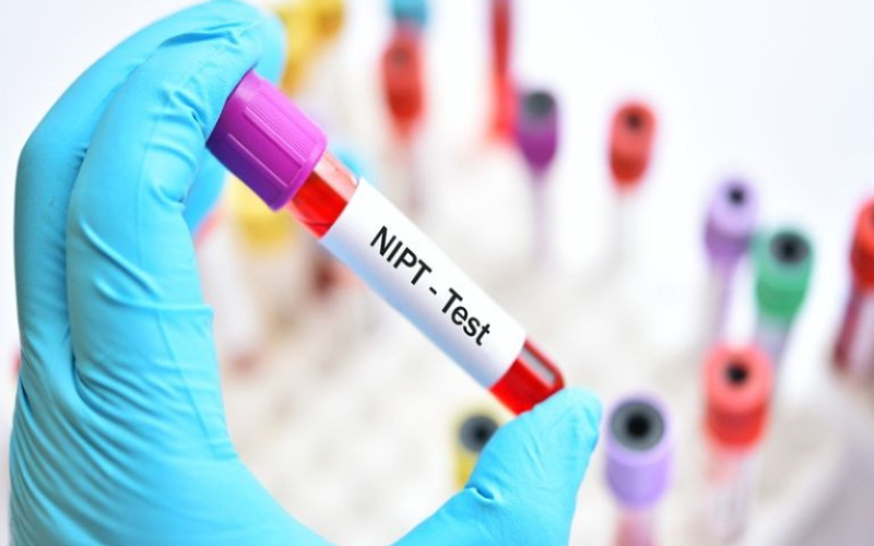 Cách đọc kết quả xét nghiệm NIPT đúng cách mẹ bầu cần biết 2