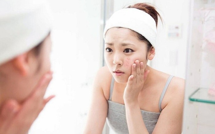 cach-lam-mat-na-ngu-hoa-voi-sua-tuoi-khong-duong 1.jpg