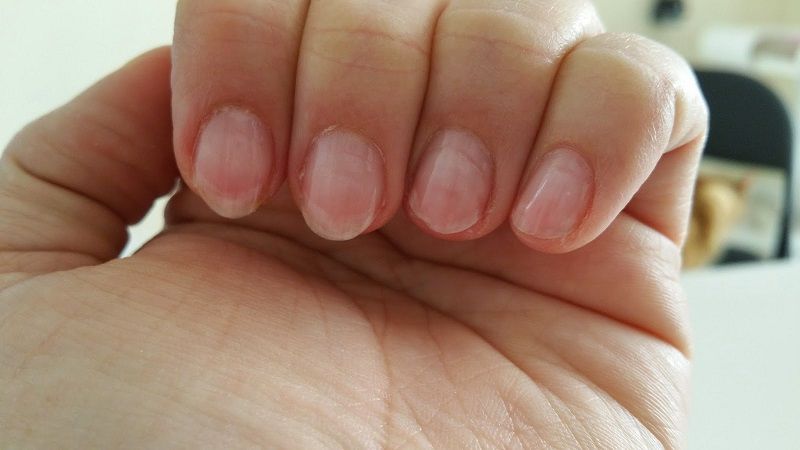 Cách làm móng tay nhanh dài trong 2 ngày tại nhà 1